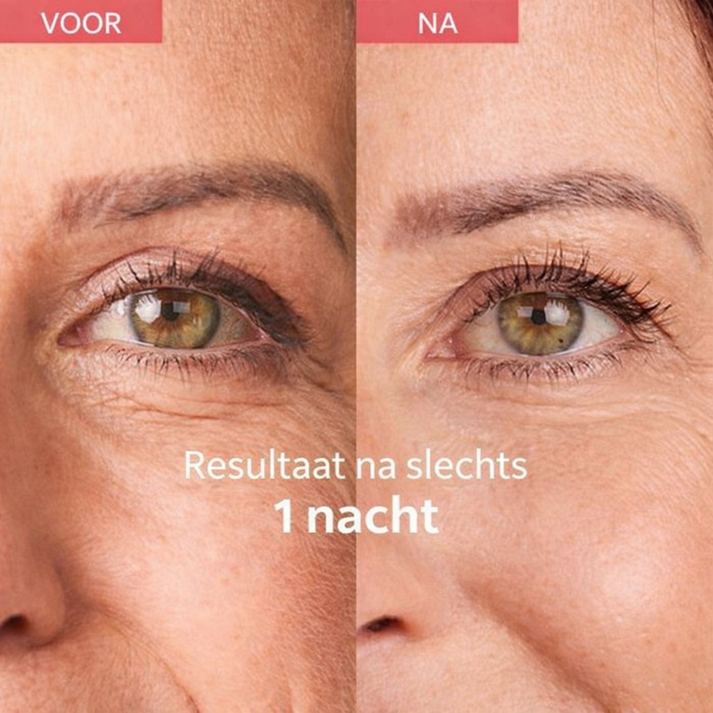 Avond Rimpel Routine PRO – Cupping, Sleeping Tape & Serum